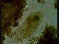 File:Frontonia ingesting a diatom.ogg