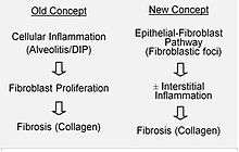 Etiology and pathobiology of Idiopathic Pulmonary Fibrosis (IPF)