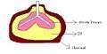 IPP lungs.jpg