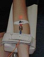 An intravenous blood irradiation therapy in use.