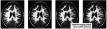 Illustration of changing both gray levels in an imaging which is classical warping from Michael Jackson video as well as diffeomorphic orbit transformation.,