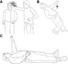 A schematic demonstrates the fencing response in three stages. First a man is struck across the face by another. Second he falls while his left arm begins to extend. Third he is on the ground unconscious with left arm raised in the air.